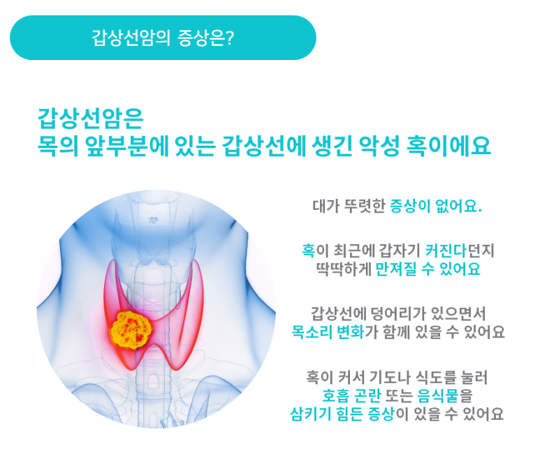 갑상선암의 증상 [출처 : 국가암정보센터]