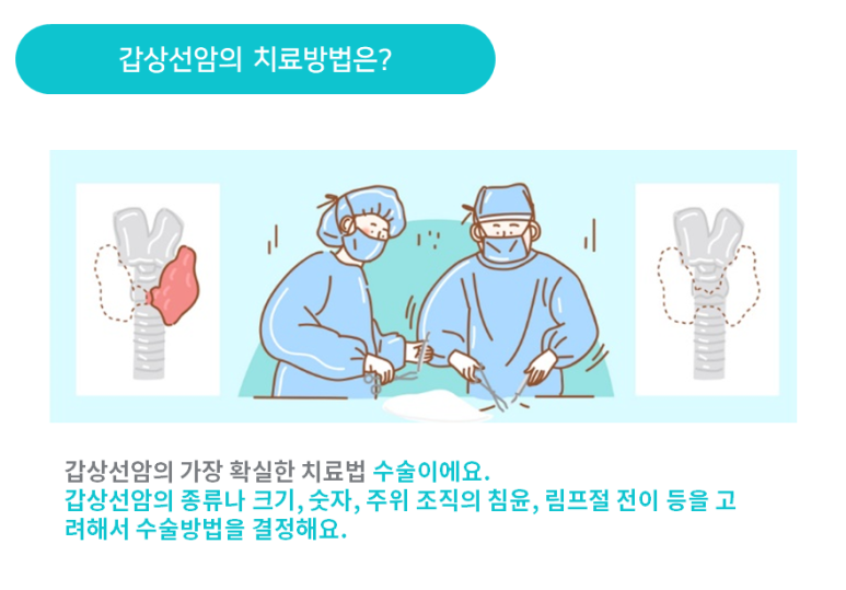 갑상선암 치료방법